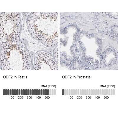 Immunohistochemistry-Paraffin: ODF2 Antibody [NBP1-85417] - Staining in human testis and prostate tissues using anti-ODF2 antibody. Corresponding ODF2 RNA-seq data are presented for the same tissues.