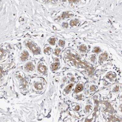 Immunohistochemistry-Paraffin ODF2L Antibody - BSA Free