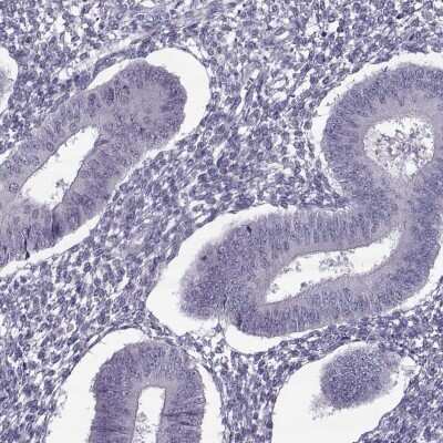 Immunohistochemistry-Paraffin ODF3 Antibody