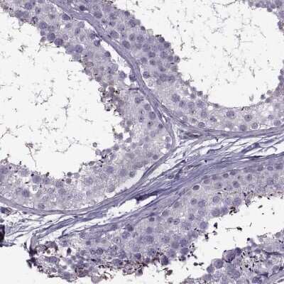 Immunohistochemistry-Paraffin ODF3 Antibody