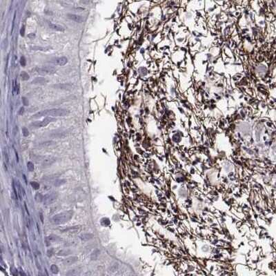 Immunohistochemistry-Paraffin: ODF3 Antibody [NBP2-32628] - Staining of human epididymis.