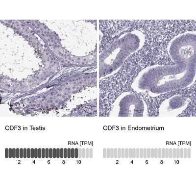 Immunohistochemistry-Paraffin ODF3 Antibody