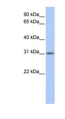 Western Blot: ODF3L1 Antibody [NBP1-56392] - Human Placenta lysate, concentration 0.2-1 ug/ml.