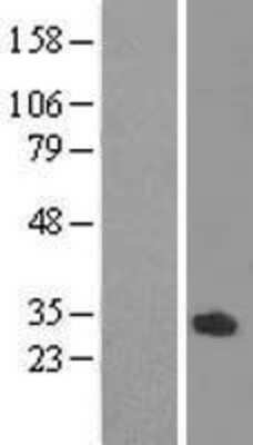 Western Blot: ODF3L1 Overexpression Lysate (Adult Normal) [NBL1-13909] Left-Empty vector transfected control cell lysate (HEK293 cell lysate); Right -Over-expression Lysate for ODF3L1.