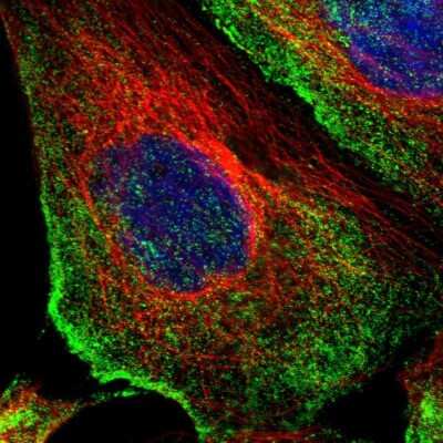 Immunocytochemistry/Immunofluorescence: ODR4/TTG1 Antibody [NBP1-82177] - Immunofluorescent staining of human cell line A-431 shows localization to plasma membrane.