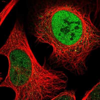 Immunocytochemistry/Immunofluorescence: ODR4/TTG1 Antibody [NBP2-58718] - Staining of human cell line U-2 OS shows localization to nucleoplasm.