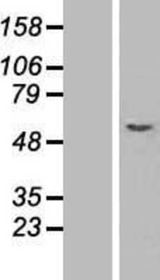 Western Blot: ODR4/TTG1 Overexpression Lysate (Adult Normal) [NBL1-08317] Left-Empty vector transfected control cell lysate (HEK293 cell lysate); Right -Over-expression Lysate for ODR4/TTG1.