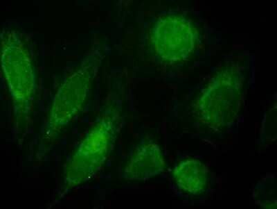 Immunocytochemistry/Immunofluorescence: ODZ3 Antibody [NBP1-20956] - Staining of nuclei HeLa cells (green). Antibody at 10 ug/mL.
