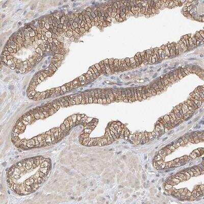 Immunohistochemistry: OFD1 Antibody [NBP1-89354] - Staining of human prostate shows distinct cytoplasmic and membranous positivity in glandular cells.