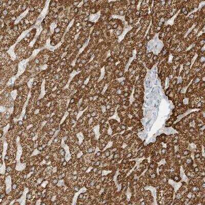 Immunohistochemistry-Paraffin: OFD1 Antibody [NBP1-89356] - Staining of human liver shows strong cytoplasmic positivity in hepatocytes.