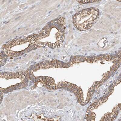 Immunohistochemistry-Paraffin: OFD1 Antibody [NBP1-89354] - Staining of human prostate shows moderate membranous positivity in glandular cells.