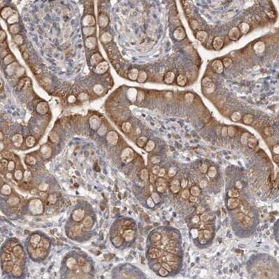 Immunohistochemistry-Paraffin: OFD1 Antibody [NBP1-89354] - Staining of human small intestine shows moderate  cytoplasmic positivity in glandular cells.