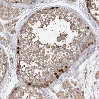 Immunohistochemistry-Paraffin: OFD1 Antibody [NBP1-89354] - Staining of human testis shows strong nuclear positivity in a subset of cells in seminiferous ducts.