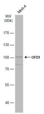 Western Blot: OFD1 Antibody [NBP1-32843] - Whole cell extract (30 ug) was separated by 7.5% SDS-PAGE, and the membrane was blotted with OFD1 antibody diluted at 1:5000.