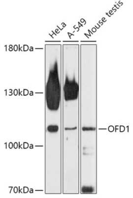 Western Blot: OFD1 Antibody [NBP2-94231] - Analysis of extracts of various cell lines, using OFD1 at 1:1000 dilution.Secondary antibody: HRP Goat Anti-Rabbit IgG (H+L) at 1:10000 dilution.Lysates/proteins: 25ug per lane.Blocking buffer: 3% nonfat dry milk in TBST.Detection: ECL Basic Kit .Exposure time: 90s.