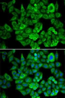 Immunocytochemistry/Immunofluorescence: OGDH Antibody [NBP2-93877] - Analysis of U2OS cells using OGDH . Blue: DAPI for nuclear staining.