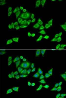 Immunocytochemistry/Immunofluorescence: OGDH Antibody [NBP2-94086] - Analysis of U2OS cells using OGDH . Blue: DAPI for nuclear staining.