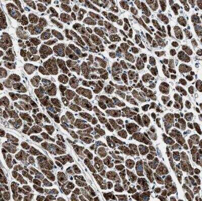 Immunohistochemistry-Paraffin: OGDH Antibody [NBP1-84947] - Staining of human heart muscle shows strong cytoplasmic positivity.