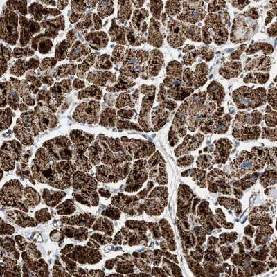 Immunohistochemistry-Paraffin: OGDH Antibody [NBP1-84948] - Staining of human heart muscle shows strong granular cytoplasmic positivity in cardiomyocytes.