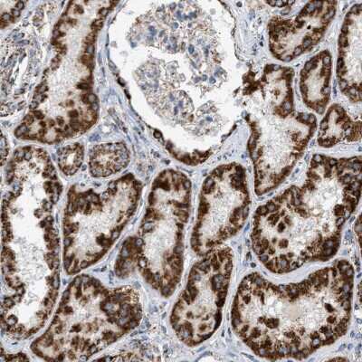 Immunohistochemistry-Paraffin: OGDH Antibody [NBP1-84948] - Staining of human kidney shows strong granular cytoplasmic positivity in cells in tubules.