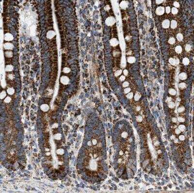 Immunohistochemistry-Paraffin: OGDH Antibody [NBP1-84948] - Staining of human duodenum shows strong granular cytoplasmic positivity in glandular cells.