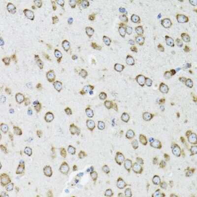 Immunohistochemistry-Paraffin: OGDH Antibody [NBP2-94086] - Paraffin-embedded mouse brain using OGDH .