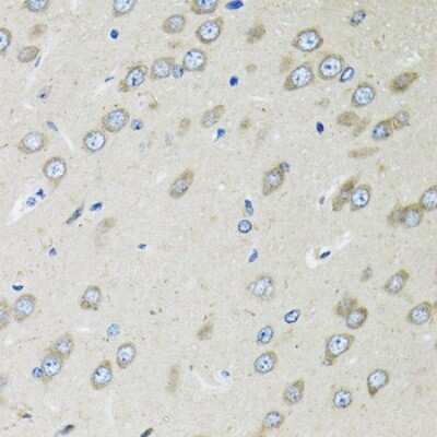 Immunohistochemistry-Paraffin: OGDH Antibody [NBP2-94086] - Paraffin-embedded rat brain using OGDH .