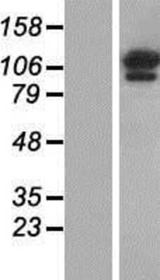 Western Blot: OGDH Overexpression Lysate (Adult Normal) [NBP2-08097] Left-Empty vector transfected control cell lysate (HEK293 cell lysate); Right -Over-expression Lysate for OGDH.