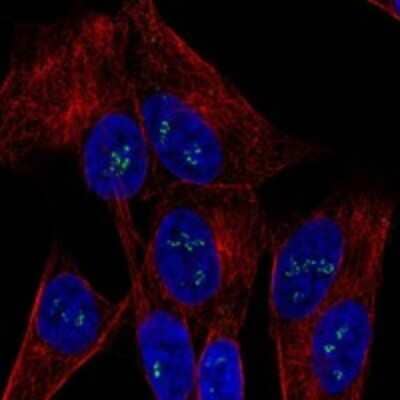 Immunocytochemistry/Immunofluorescence: OGDHL Antibody [NBP3-17407] - Staining of human cell line SH-SY5Y shows localization to nucleoli fibrillar center.