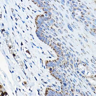 Immunohistochemistry-Paraffin: OGDHL Antibody [NBP2-94830] - Immunohistochemistry of paraffin-embedded human esophageal using OGDHL Rabbit pAb (NBP2-94830) at dilution of 1:200 (40x lens). Perform high pressure antigen retrieval with 10 mM citrate buffer pH 6.0 before commencing with IHC staining protocol.