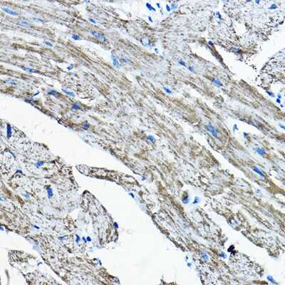 Immunohistochemistry-Paraffin: OGDHL Antibody [NBP2-94830] - Immunohistochemistry of paraffin-embedded mouse heart using OGDHL Rabbit pAb (NBP2-94830) at dilution of 1:200 (40x lens). Perform high pressure antigen retrieval with 10 mM citrate buffer pH 6.0 before commencing with IHC staining protocol.