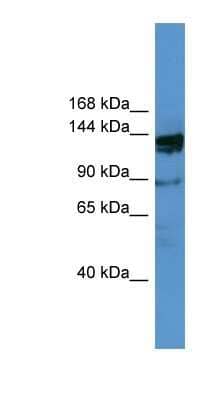 Western Blot: OGDHL Antibody [NBP1-91486] - Titration: 0.2-1 ug/ml, Positive Control: COLO205 cell lysate.