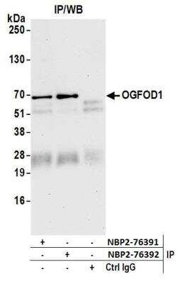 Immunoprecipitation: OGFOD1 Antibody [NBP2-76392] - Samples: Whole cell lysate (1.0 mg per IP reaction; 20% of IP loaded) from HeLa cells prepared using NETN lysis buffer. Antibodies: Affinity purified rabbit anti-OGFOD1 antibody NBP2-76392 used for IP at 100 ul per reaction. OGFOD1 was also immunoprecipitated by rabbit anti-OGFOD1 antibody NBP2-76391. For blotting immunoprecipitated OGFOD1, NBP2-76392 was used at 1:1000. Detection: Chemiluminescence with an exposure time of 75 seconds.