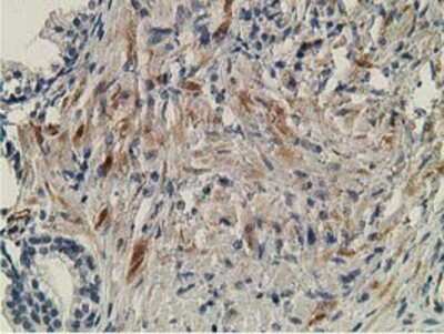 Immunohistochemistry: OGFOD1 Antibody (OTI1D9) - Azide and BSA Free [NBP2-73145] - Staining of paraffin-embedded Human prostate tissue using anti-OGFOD1 mouse monoclonal antibody.