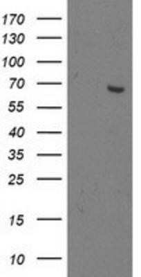 Western Blot: OGFOD1 Antibody (OTI1D9) - Azide and BSA Free [NBP2-73145] - HEK293T cells were transfected with the pCMV6-ENTRY control (Left lane) or pCMV6-ENTRY OGFOD1 (Right lane) cDNA for 48 hrs and lysed. Equivalent amounts of cell lysates (5 ug per lane) were separated by SDS-PAGE and immunoblotted with anti-OGFOD1.