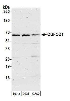 Western Blot: OGFOD1 Antibody [NBP2-76392] - Samples: Whole cell lysate (50 ug) from HeLa, HEK293T, and K-562 cells prepared using NETN lysis buffer. Antibody: Affinity purified rabbit anti-OGFOD1 antibody NBP2-76392 used for WB at 1:1000. Detection: Chemiluminescence with an exposure time of 3 minutes.