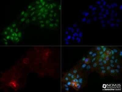 Immunocytochemistry/Immunofluorescence: OGG1 Antibody (4E8) - Azide and BSA Free [NBP2-80890] - A431 cells were fixed for 10 minutes using 10% formalin and then permeabilized for 5 minutes using 1X TBS + 0.5% Triton X-100. The cells were incubated with OGG1 (4E8) at a 1:100 dilution overnight at 4C and detected with DyLight 488 (Green) at a 1:500 dilution. Actin was detected with Phalloidin 568 (Red) at a 1:200 dilution. Nuclei were detected with DAPI (Blue) at 2.0 ug/ml in 1X PBS. Cells were imaged using a 40X objective. Image from the standard format of this antibody.