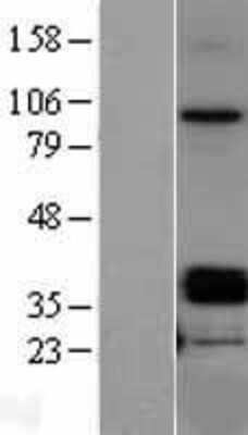 Western Blot: OIF Overexpression Lysate (Adult Normal) [NBL1-13917] Left-Empty vector transfected control cell lysate (HEK293 cell lysate); Right -Over-expression Lysate for OIF.