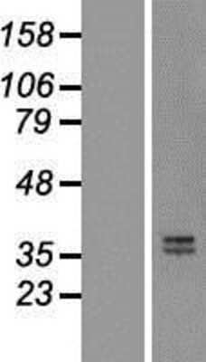 Western Blot: OIF Overexpression Lysate (Adult Normal) [NBL1-13918] Left-Empty vector transfected control cell lysate (HEK293 cell lysate); Right -Over-expression Lysate for OIF.