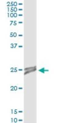 Immunoprecipitation: OIP5 Antibody (3G10-1D5) [H00011339-M01] - Analysis of OIP5 transfected lysate using anti-OIP5 monoclonal antibody and Protein A Magnetic Bead, and immunoblotted with OIP5 MaxPab rabbit polyclonal antibody.
