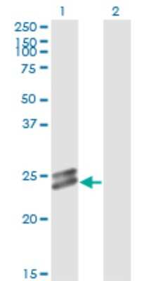 Western Blot OIP5 Antibody (3G10-1D5) - Azide and BSA Free