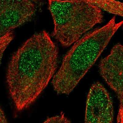 Immunocytochemistry/Immunofluorescence: OIP5 Antibody [NBP2-13688] - Staining of human cell line PC-3 shows localization to nucleoplasm & cytosol. Antibody staining is shown in green.