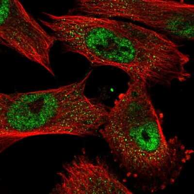 Immunocytochemistry/Immunofluorescence: OIP5 Antibody [NBP2-56649] - Staining of human cell line U-251 MG shows localization to nuclear speckles.