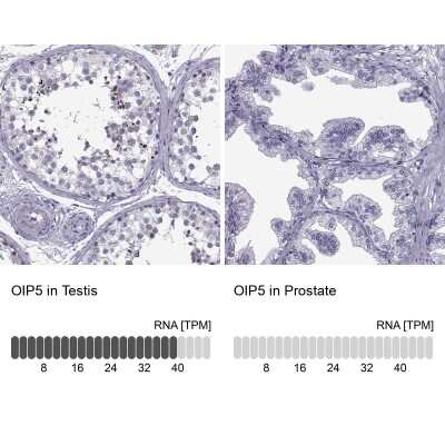 <b>Orthogonal Strategies Validation. </b>Immunohistochemistry-Paraffin: OIP5 Antibody [NBP2-13688] - Analysis in human testis and prostate tissues. Corresponding OIP5 RNA-seq data are presented for the same tissues.