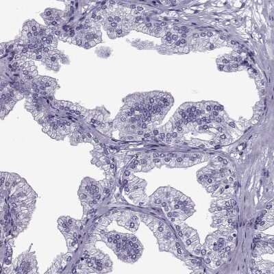 Immunohistochemistry-Paraffin: OIP5 Antibody [NBP2-13688] - Staining of human prostate shows no positivity in glandular cells as expected.