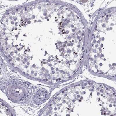 Immunohistochemistry-Paraffin: OIP5 Antibody [NBP2-13688] - Staining of human testis shows strong positivity in acrosomes.