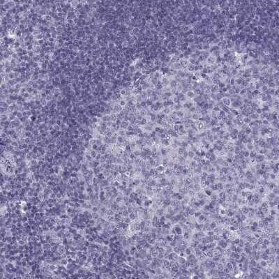Immunohistochemistry-Paraffin: OIP5 Antibody [NBP2-13688] - Staining of human tonsil shows no positivity in germinal center cells as expected.