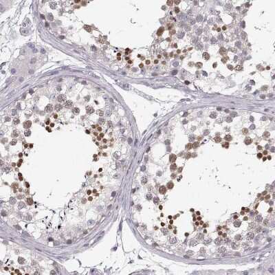 Immunohistochemistry-Paraffin: OIP5 Antibody [NBP2-56649] - Staining of human testis shows high expression.