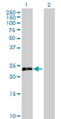 Western Blot: OIP5 Antibody [H00011339-B01P] - Analysis of OIP5 expression in transfected 293T cell line by OIP5 polyclonal antibody.  Lane 1: OIP5 transfected lysate(25.19 KDa). Lane 2: Non-transfected lysate.