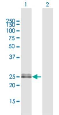 Western Blot: OIP5 Antibody [H00011339-D01P] - Analysis of OIP5 expression in transfected 293T cell line by OIP5 polyclonal antibody.Lane 1: OIP5 transfected lysate(24.70 KDa).Lane 2: Non-transfected lysate.